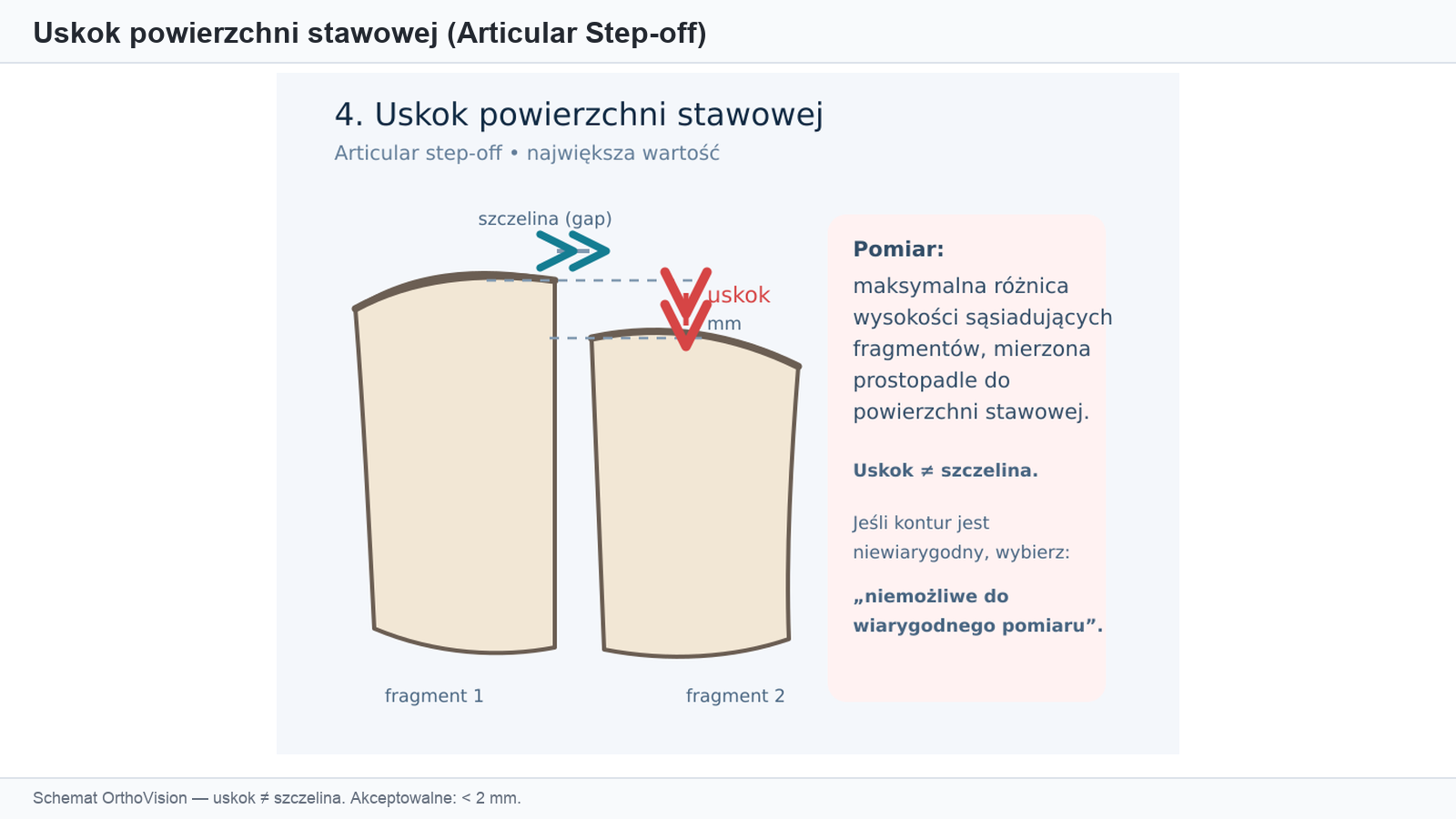 Schemat uskoku powierzchni stawowej vs szczelina