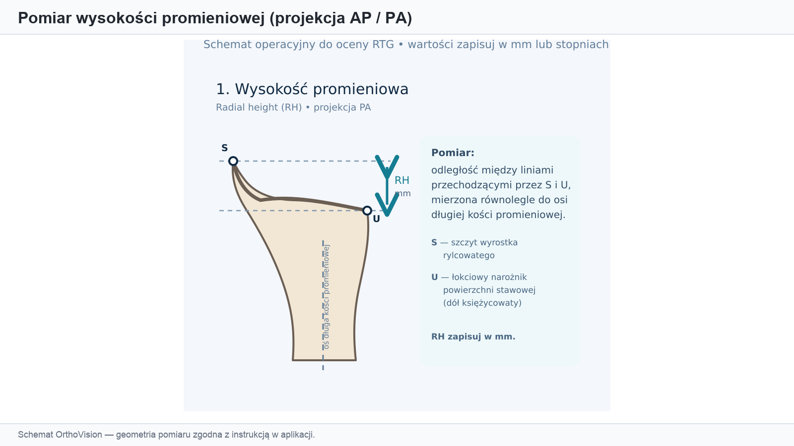 Schemat pomiaru wysokości promieniowej (projekcja AP/PA)