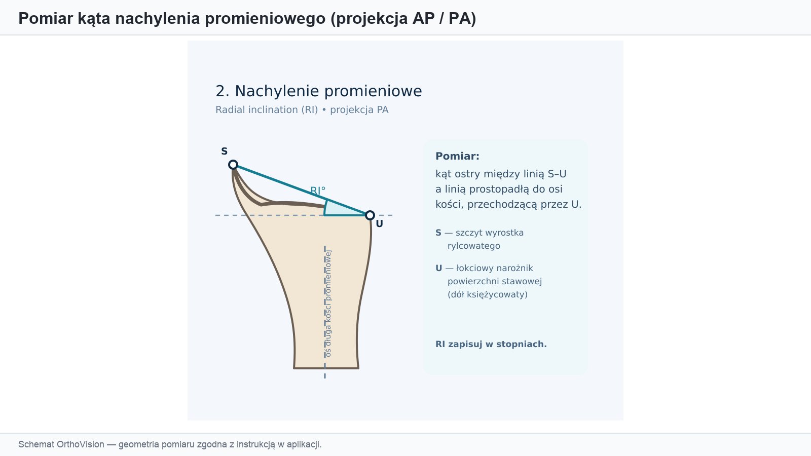 Schemat pomiaru nachylenia promieniowego (projekcja AP/PA)