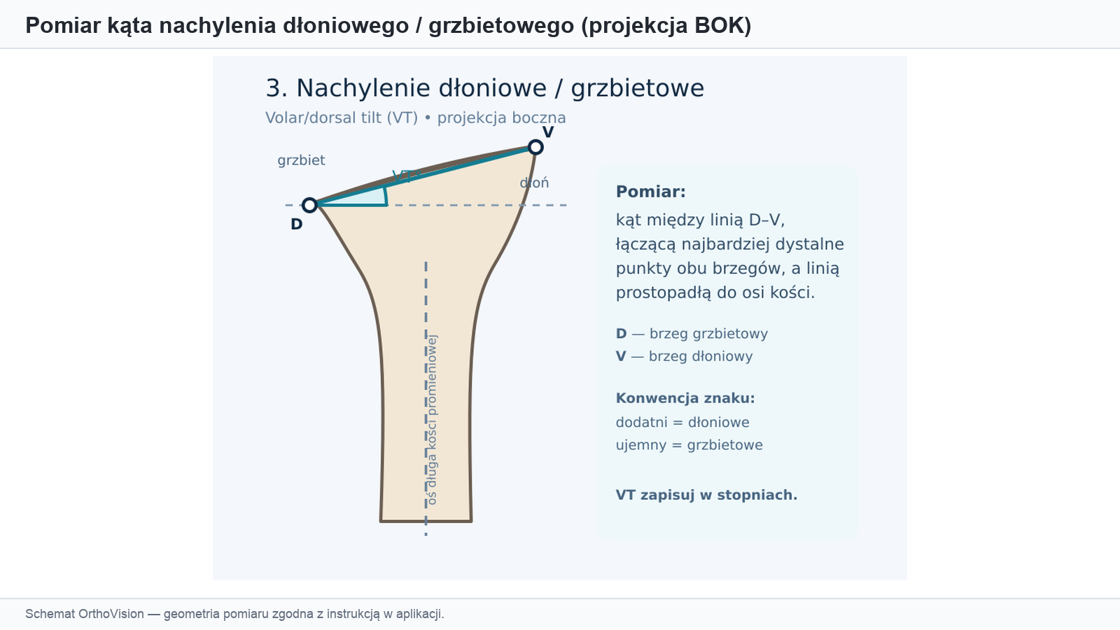 Schemat pomiaru nachylenia dłoniowego (projekcja BOK)